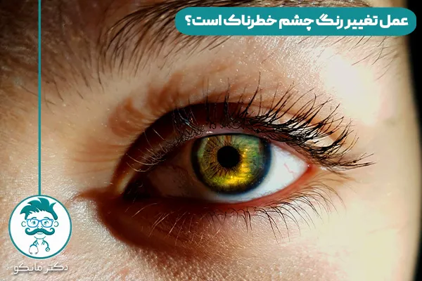 تغییر رنگ چشم