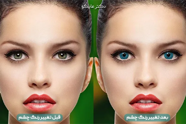 قطره تغییر رنگ چشم