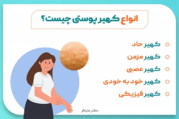 انواع کهیر پوستی
