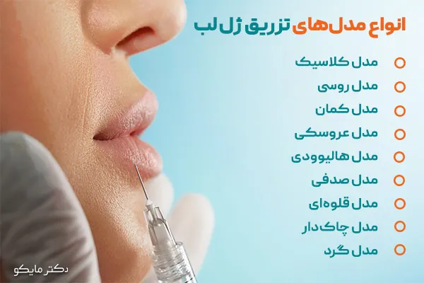انواع مدل‌های تزریق ژل لب