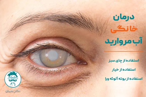 درمان خانگی آب مروارید چشم