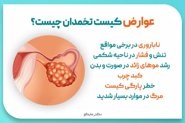 آیا کیست مویی باعث نازایی / حامله نشدن میشود؟