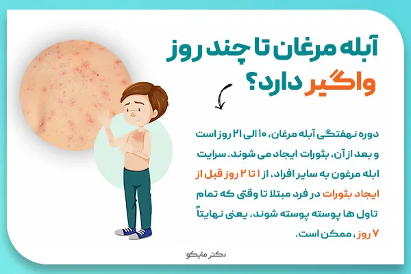 بیماری آبله مرغان تا چند روز واگیر دارد؟