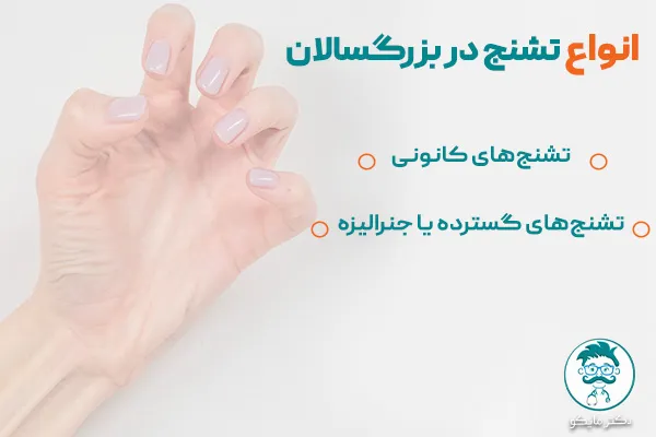 انواع تشنج در بزرگسالان