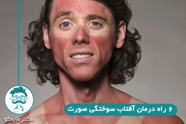  آفتاب سوختگی صورت
