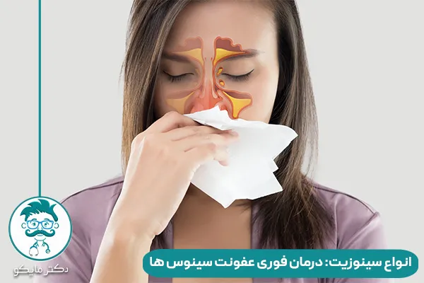 انواع سینوزیت چیست؟