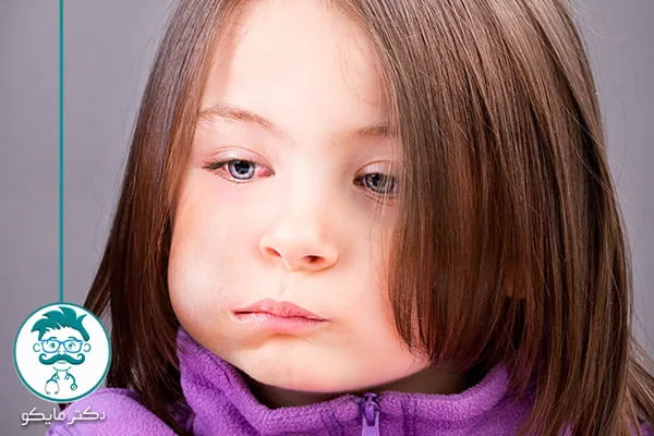 بیماری اوریون در کودکان