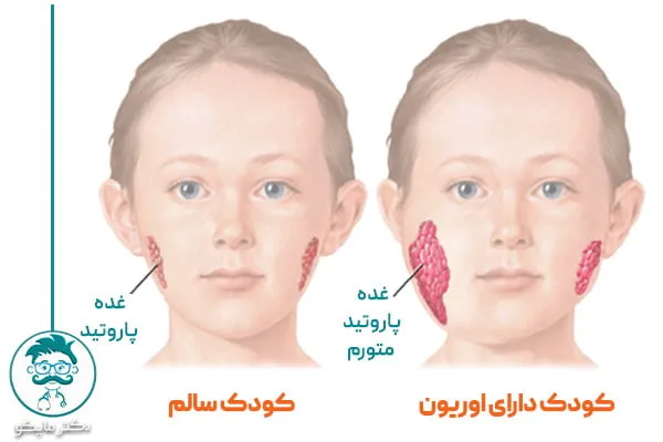 آیا اوریون واگیردار است؟