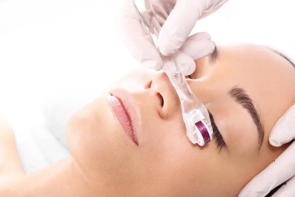 دستگاه های میکرونیدلینگ