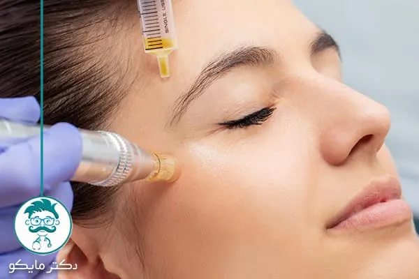 میکرونیدلینگ و مزونیدلینگ