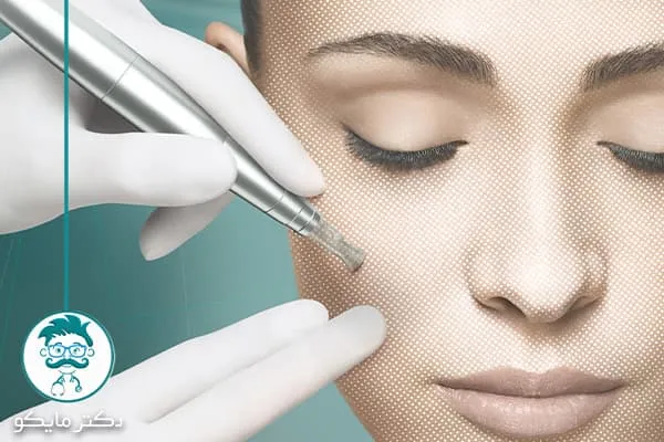 دستگاه های میکرونیدلینگ