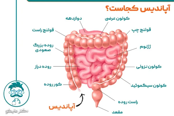 درد آپاندیس کجاست؟