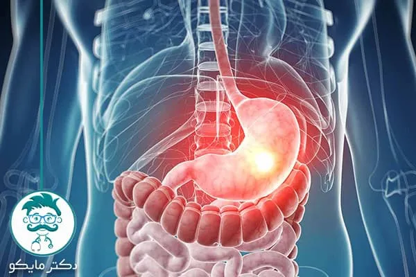 معده انسان چقدر گنجایش دارد؟