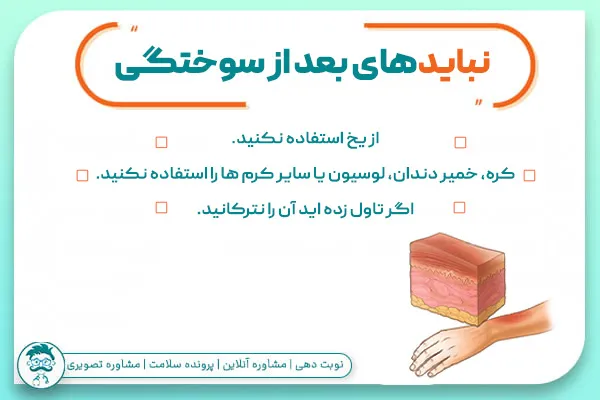 نبایدهای بعد سوختگی