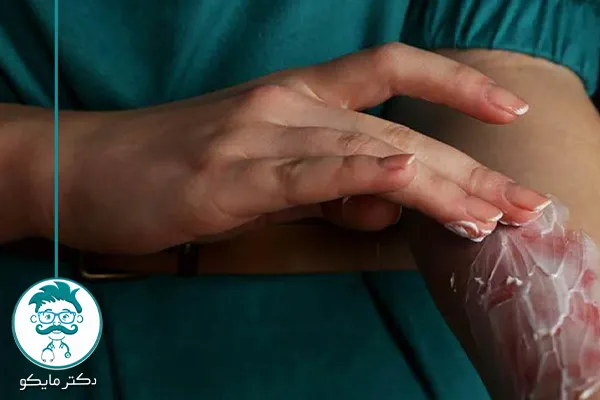 پماد سوختگی