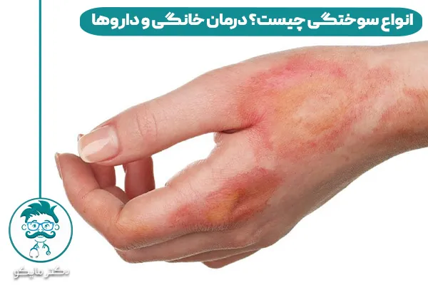 سوختگی چیست؟