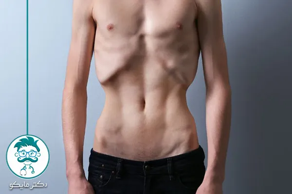 قرص برای درمان بی‌اشتهایی عصبی