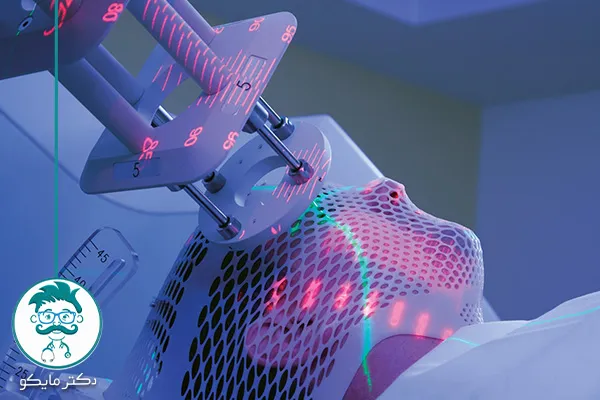 رادیوتراپی برای چه بیماری‌هایی است؟