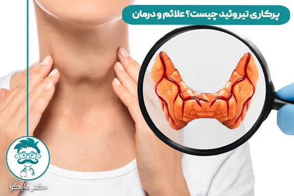 پرکاری تیروئید چیست؟ 