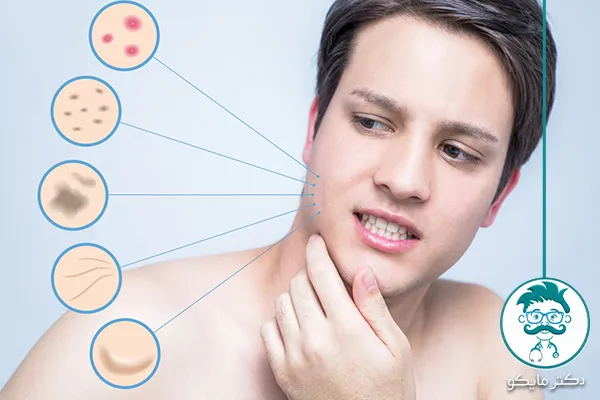 لکه‌های قهوه‌ای پوست همراه با خارش