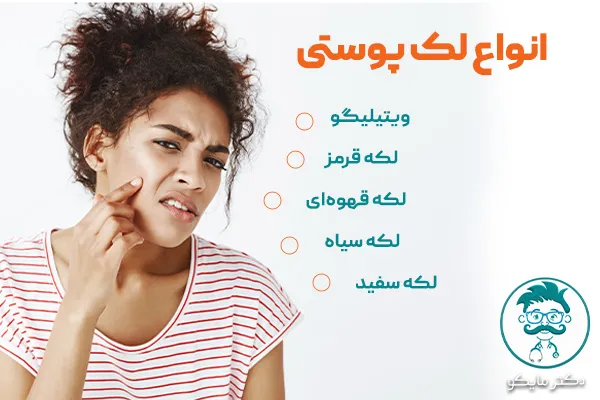 انواع لک پوستی