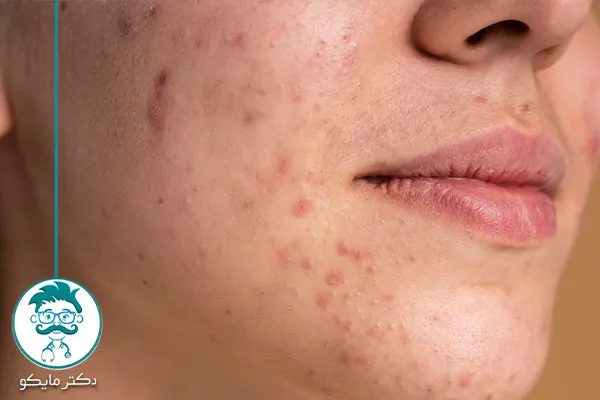 انواع لکه های پوستی خطرناک