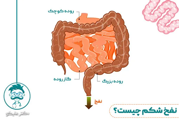 نفخ معده چیست؟