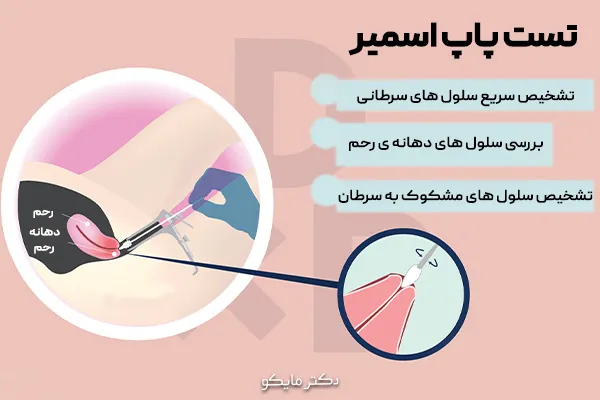 آزمایش پاپ اسمیر چه زمانی باید انجام شود؟