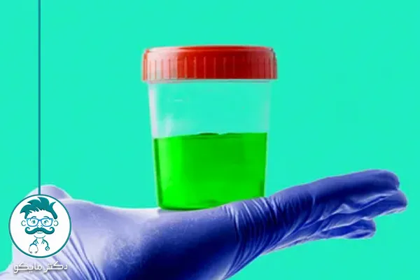 رنگ ادرار فسفری نشانه چیست؟