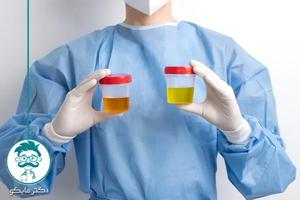 ادرار نارنجی رنگ نشانه چیست؟