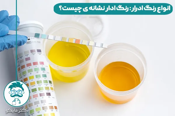 رنگ ادرار نشانه چیست؟ 
