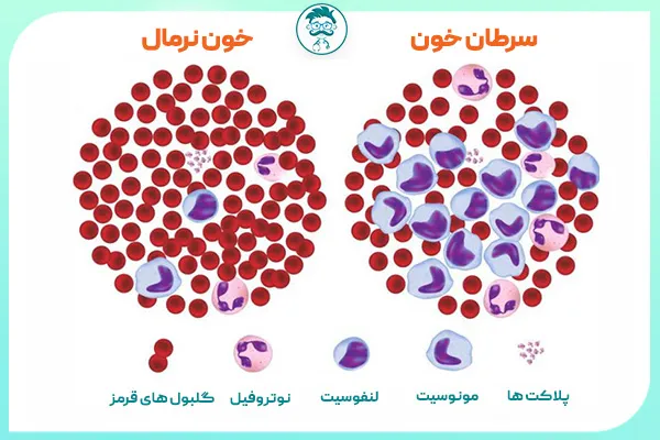 سرطان خون چیست؟