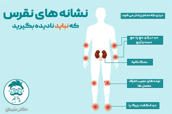 علائم نقرس در زنان و مردان