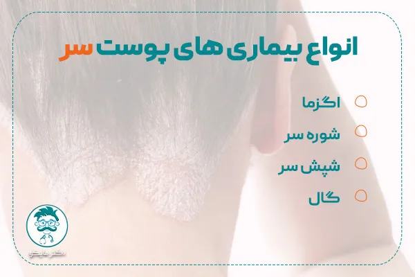 کدام بیماری پوستی خطرناک است؟