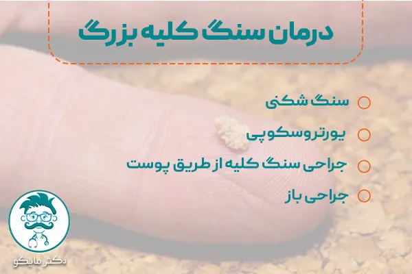 درمان سنگ کلیه بزرگ