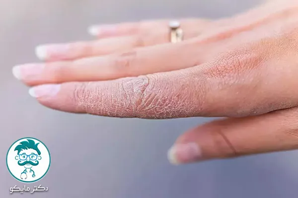 بیماری های پوستی خارش دار