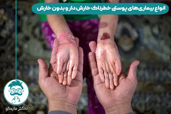 بیماری های پوستی