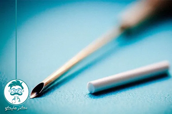 ایمپلنت ضد بارداری در ایران