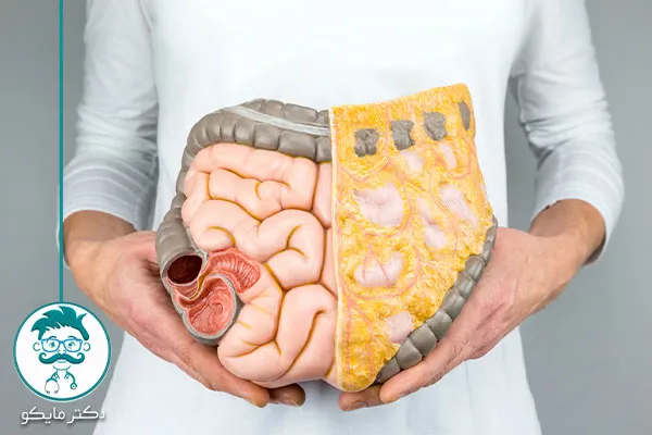 بیماری‌ های روده بزرگ