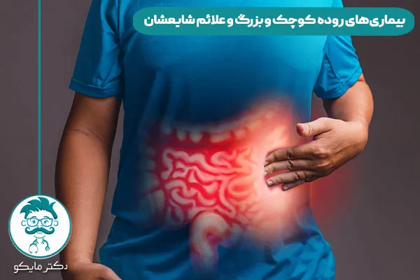  بیماری‌ های روده