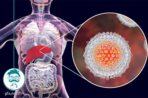 علائم بیماری هپاتیت در زنان