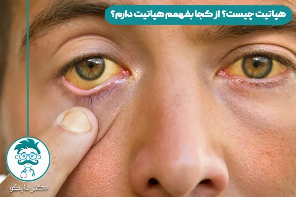هپاتیت چیست ایا خطرناک است