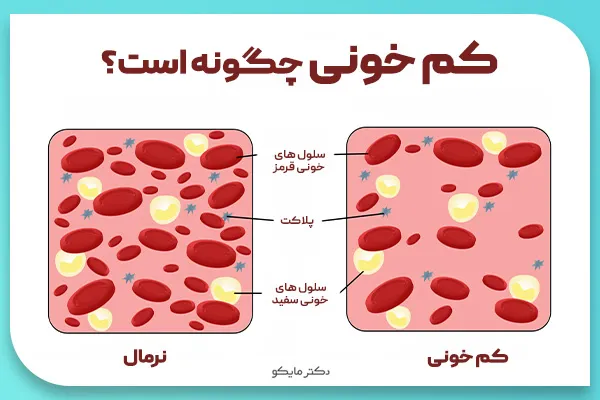 کم خونی چیست؟