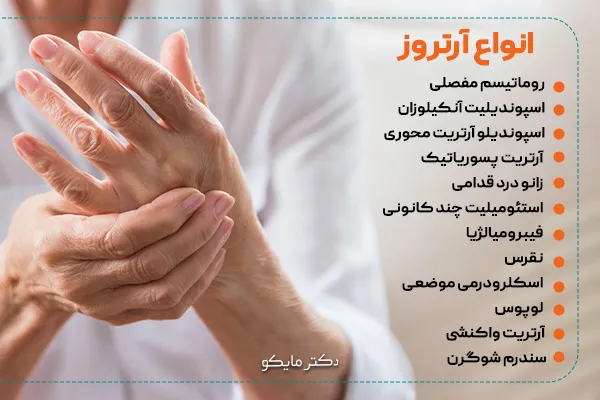 آرتروز چیست؟