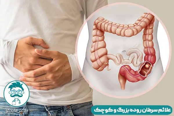 سرطان روده چیست؟