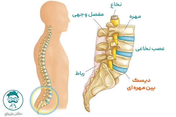 فتق دیسک کمر کجاست؟