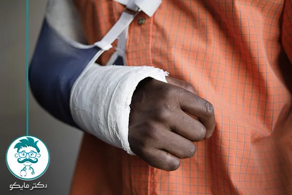 شکستگی آرنج کودکان