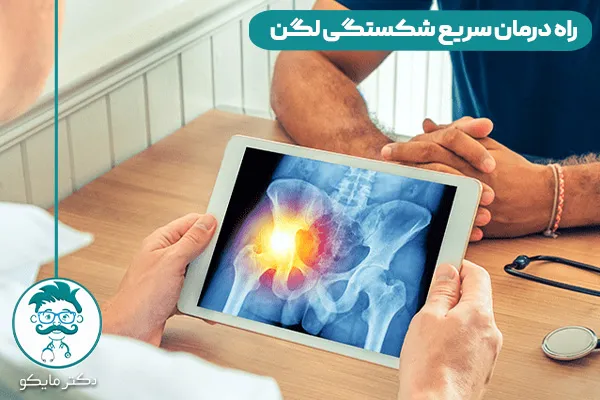 شکستگی لگن چیست؟