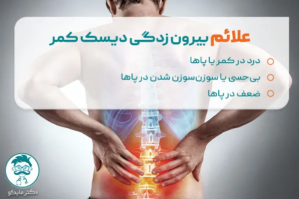علائم بیرون زدگی دیسک کمر