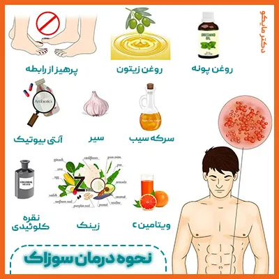 روش های درمان خانگی سوزاک